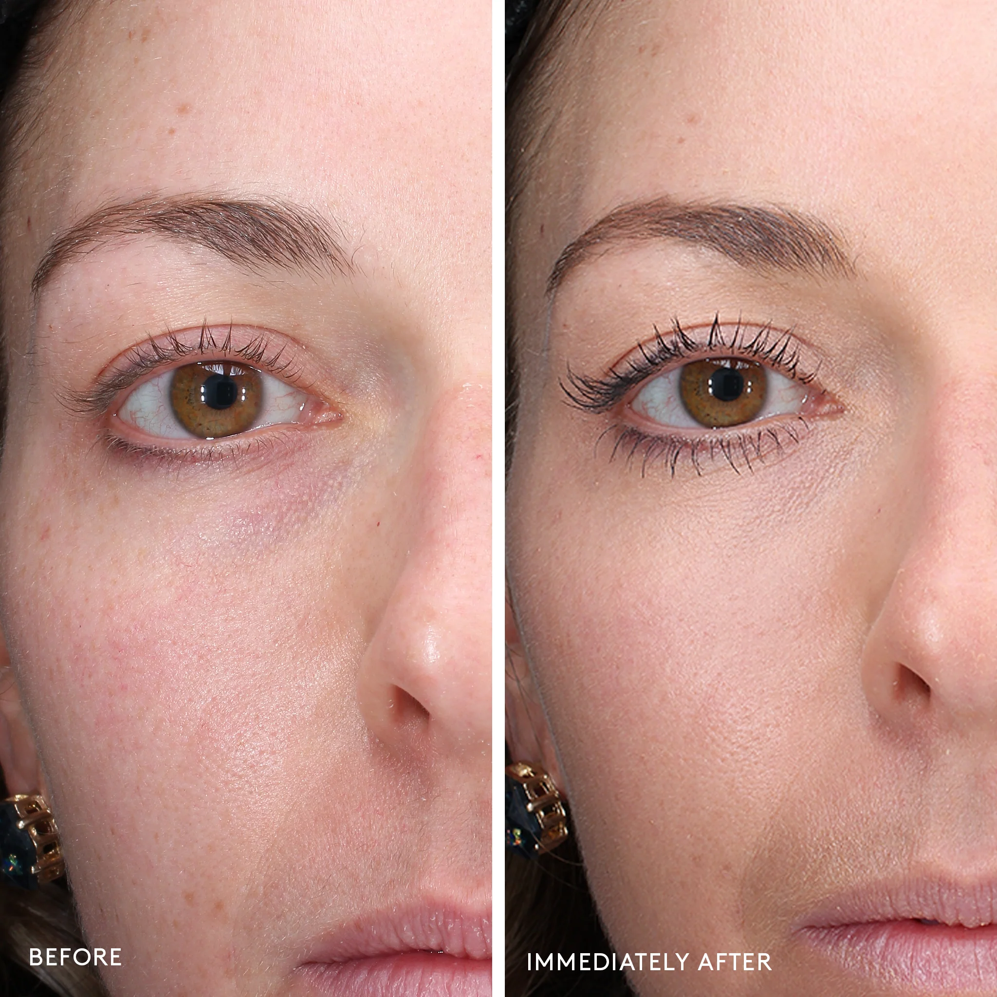 Total Eye® 3-in-1 Renewal Therapy SPF 35 - Image 12